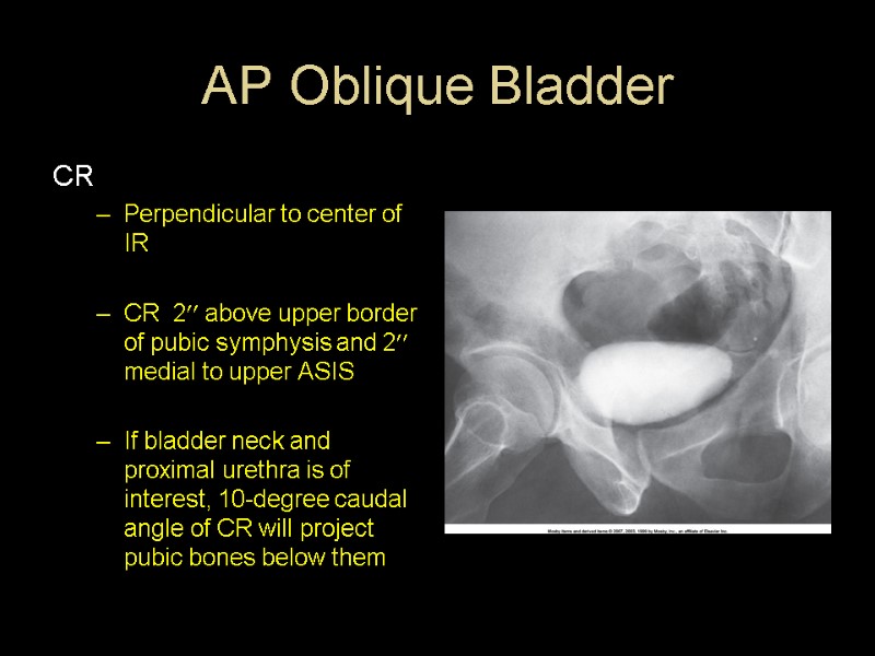 AP Oblique Bladder CR Perpendicular to center of IR  CR  2 above